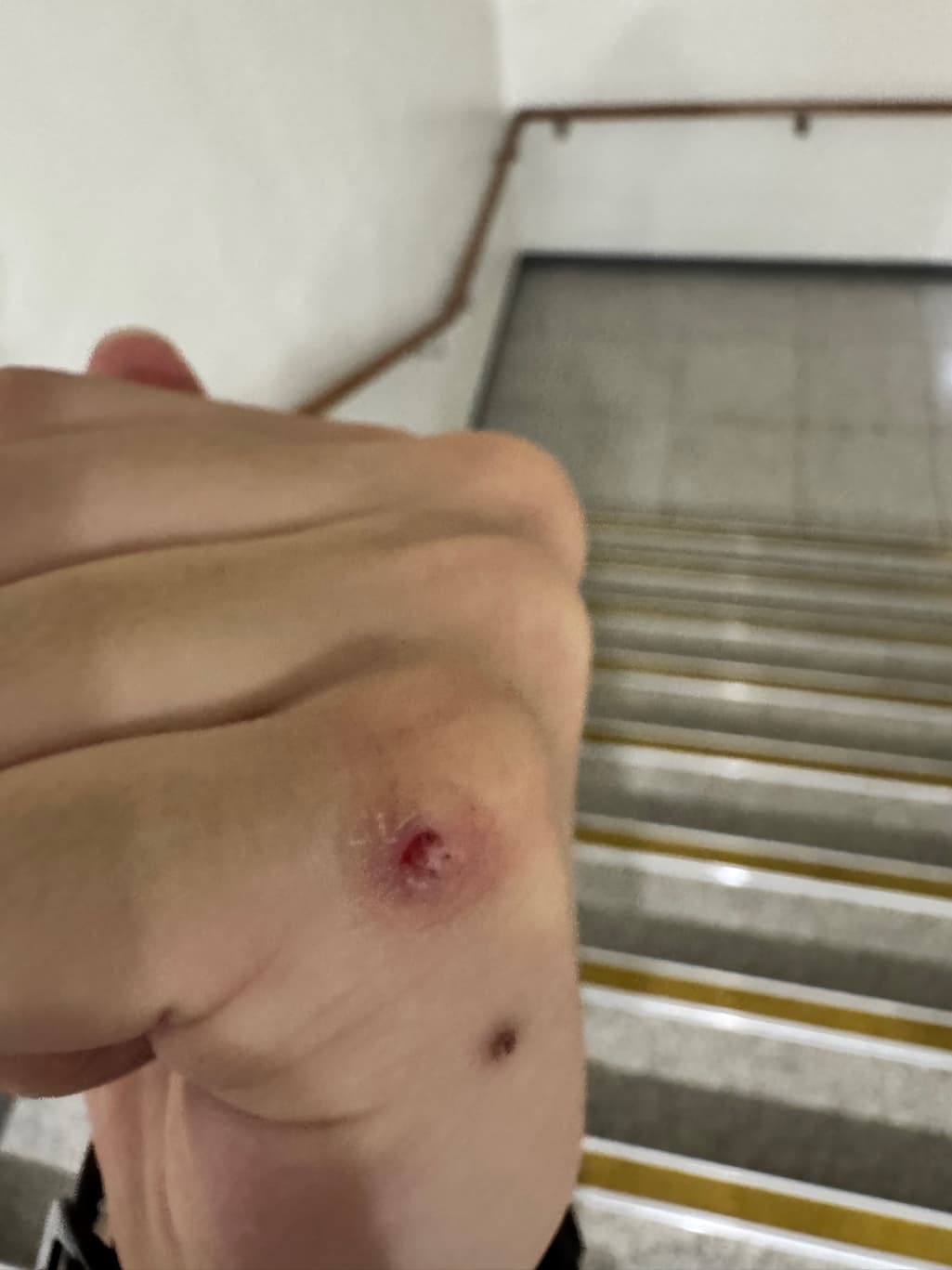 1번 째 사진