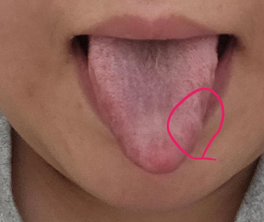 3번 째 사진