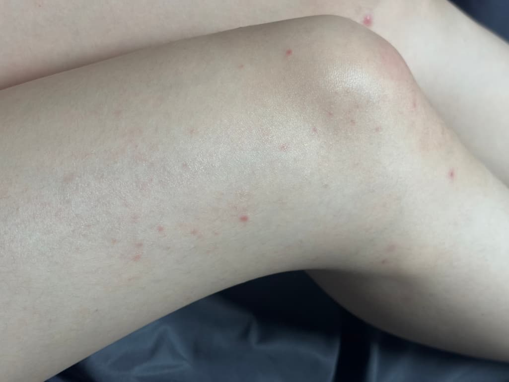 2번 째 사진