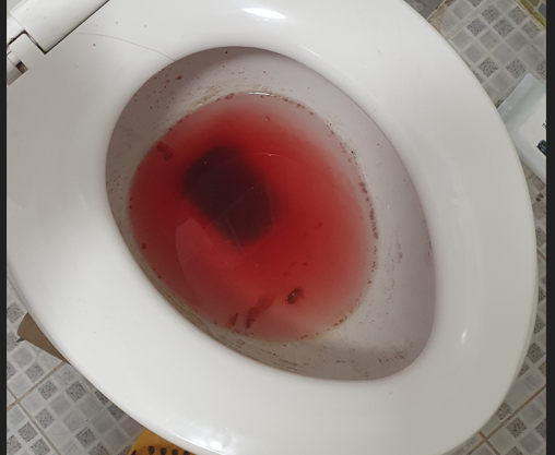 2번 째 사진