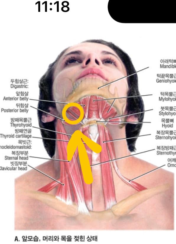 2번 째 사진