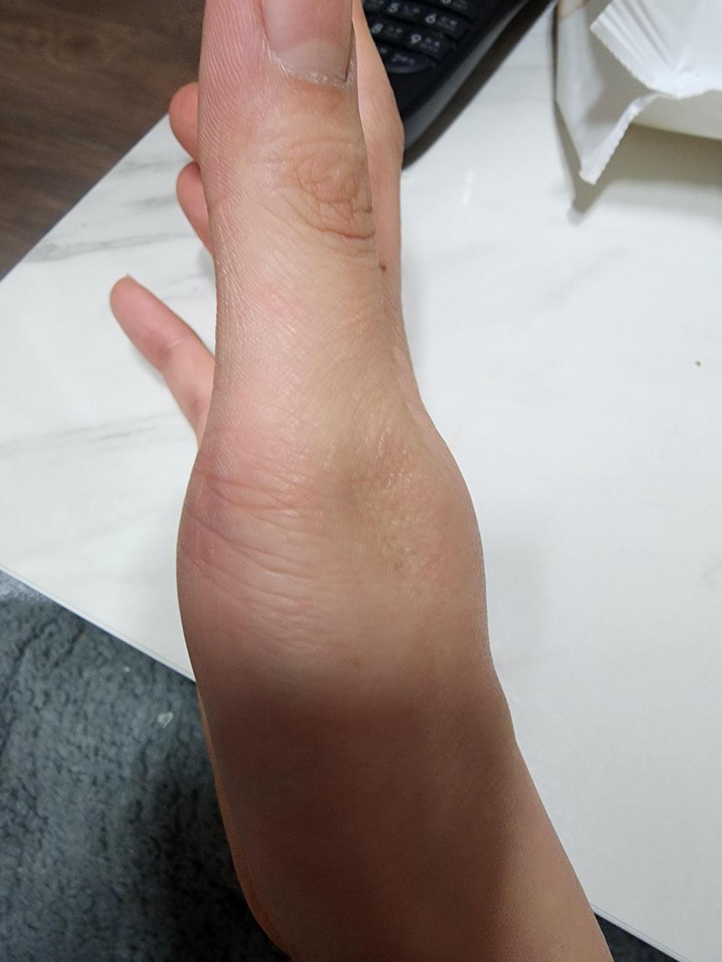 1번 째 사진