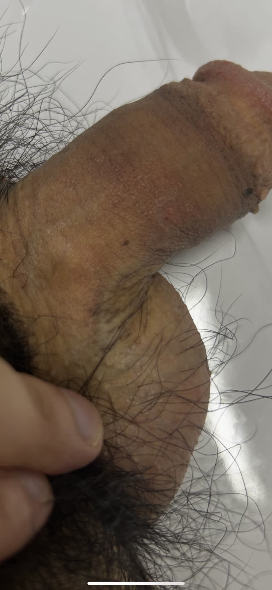 2번 째 사진
