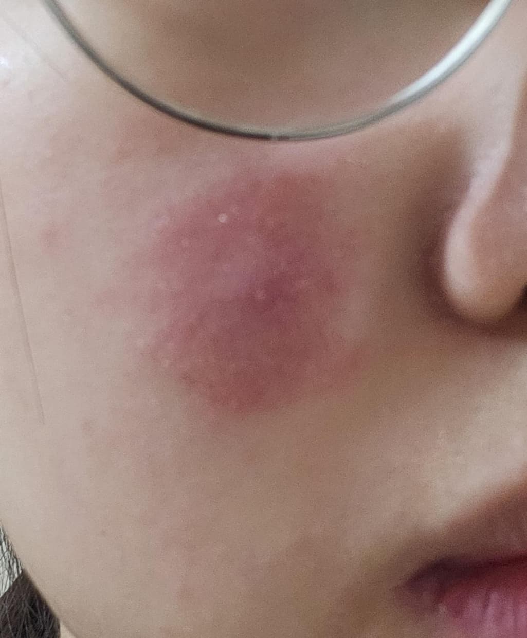 2번 째 사진