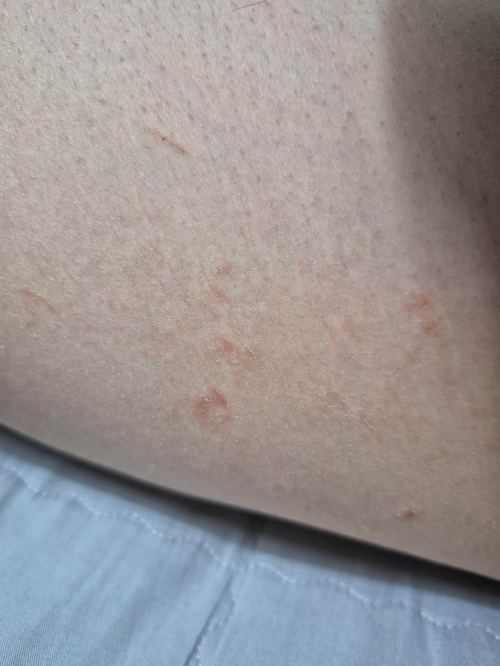 3번 째 사진