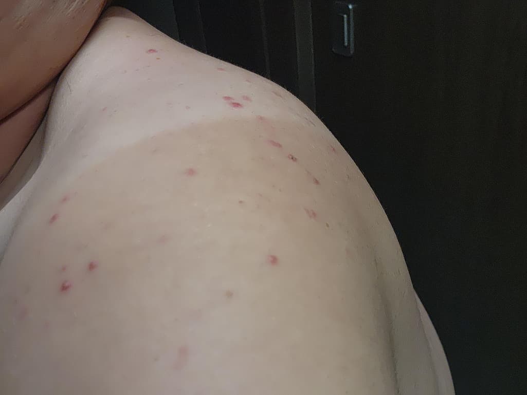 3번 째 사진