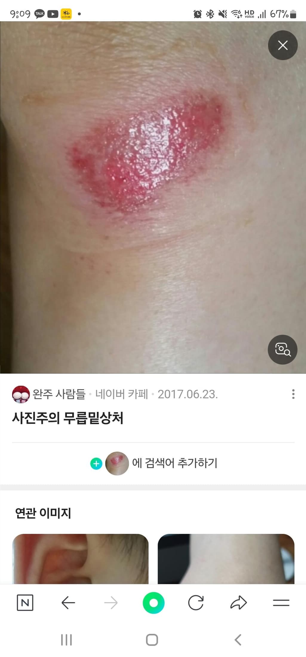 1번 째 사진