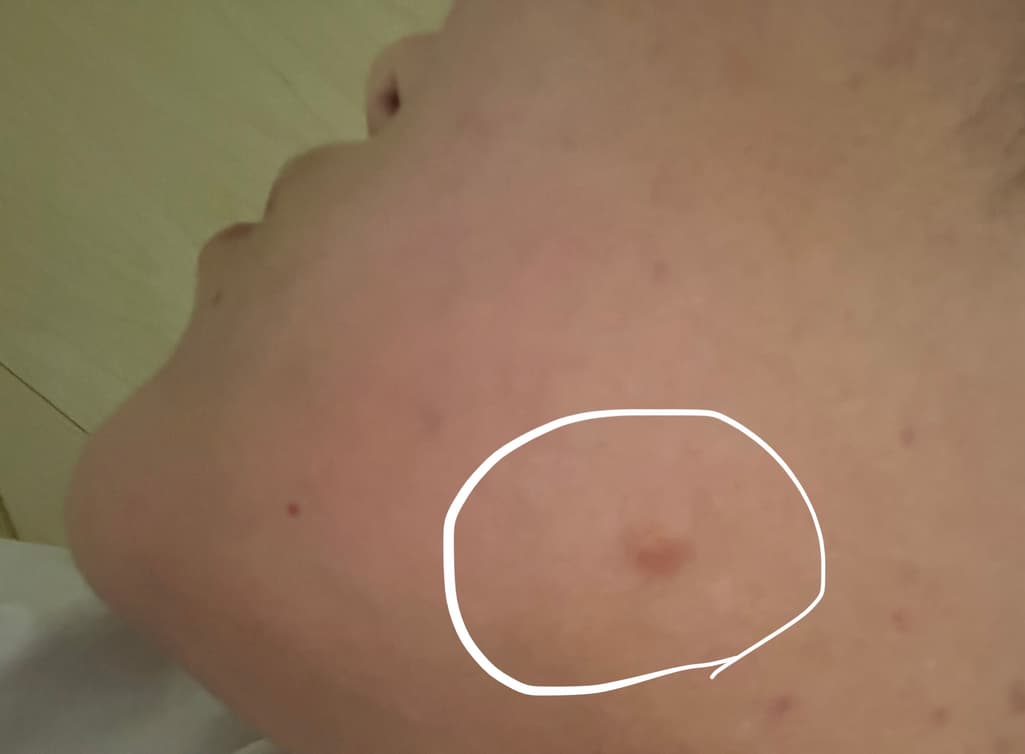 2번 째 사진