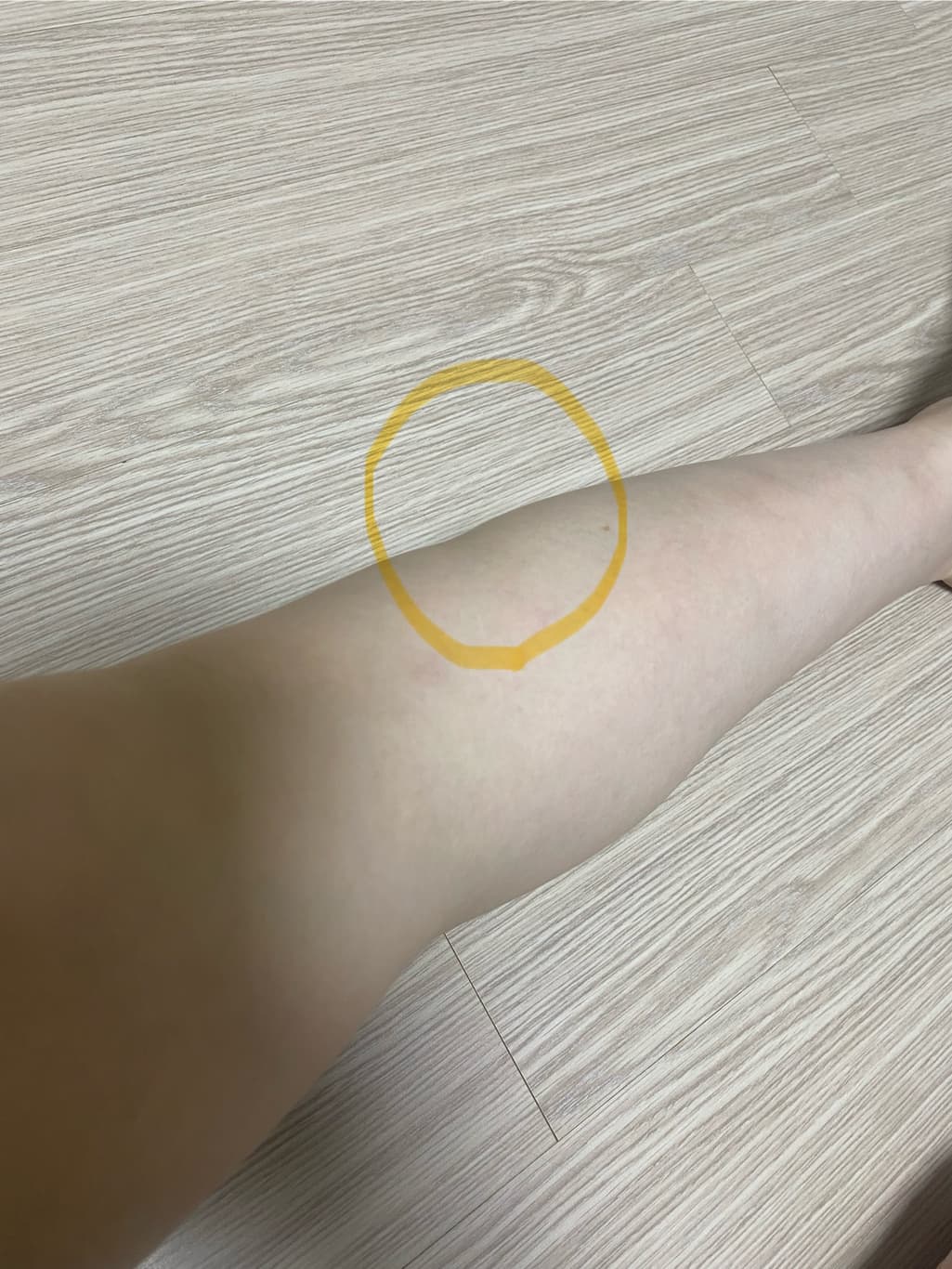 2번 째 사진
