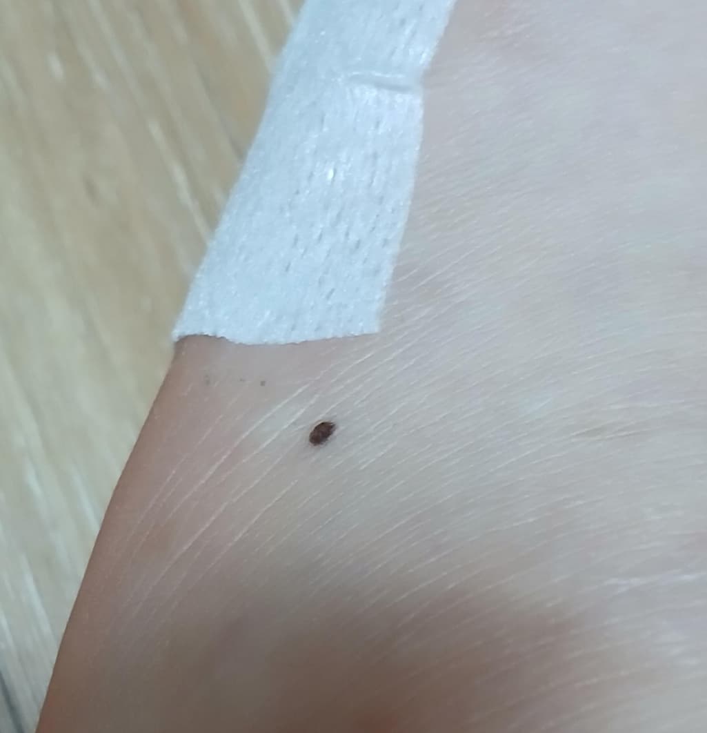 2번 째 사진