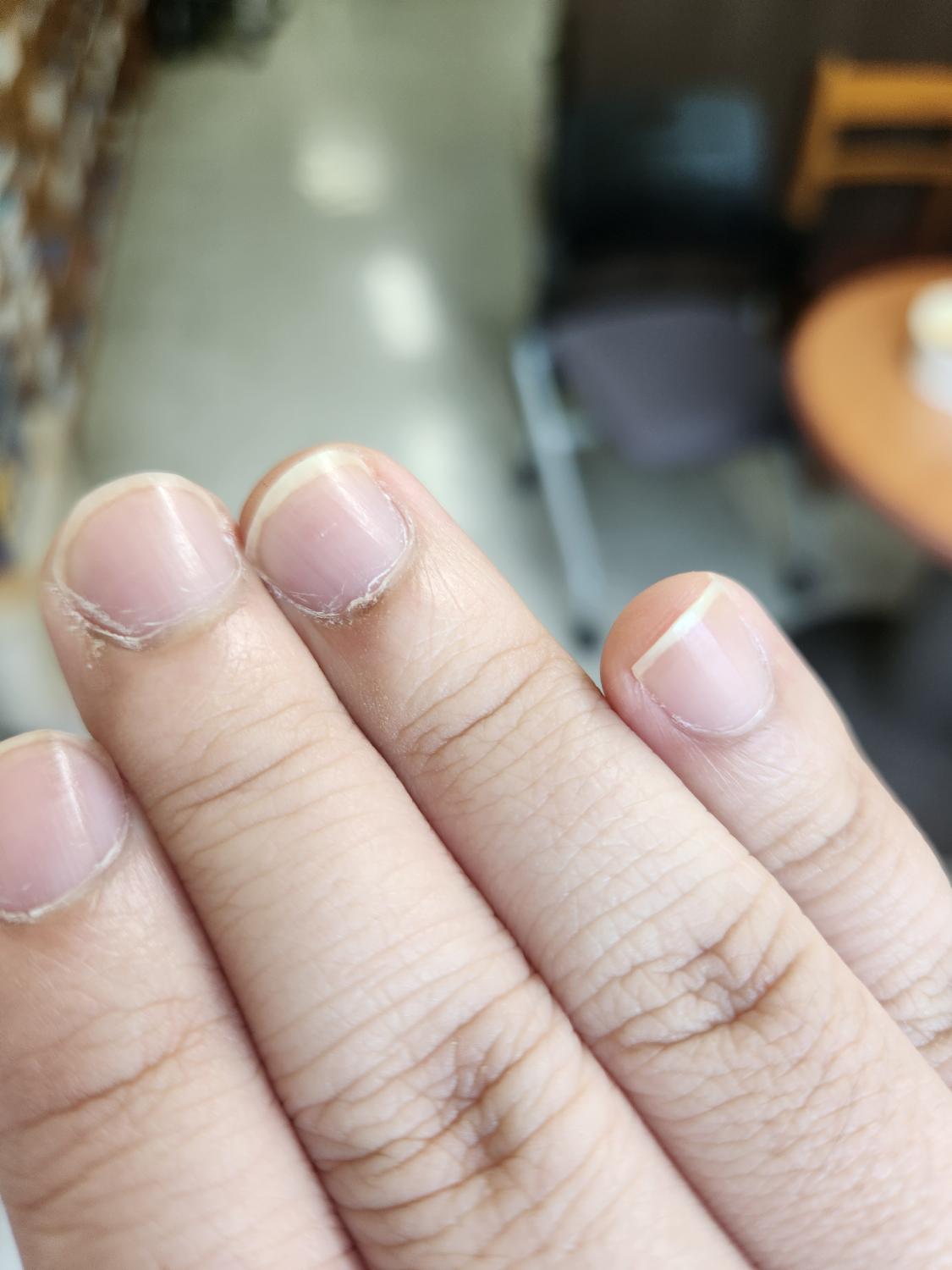 2번 째 사진