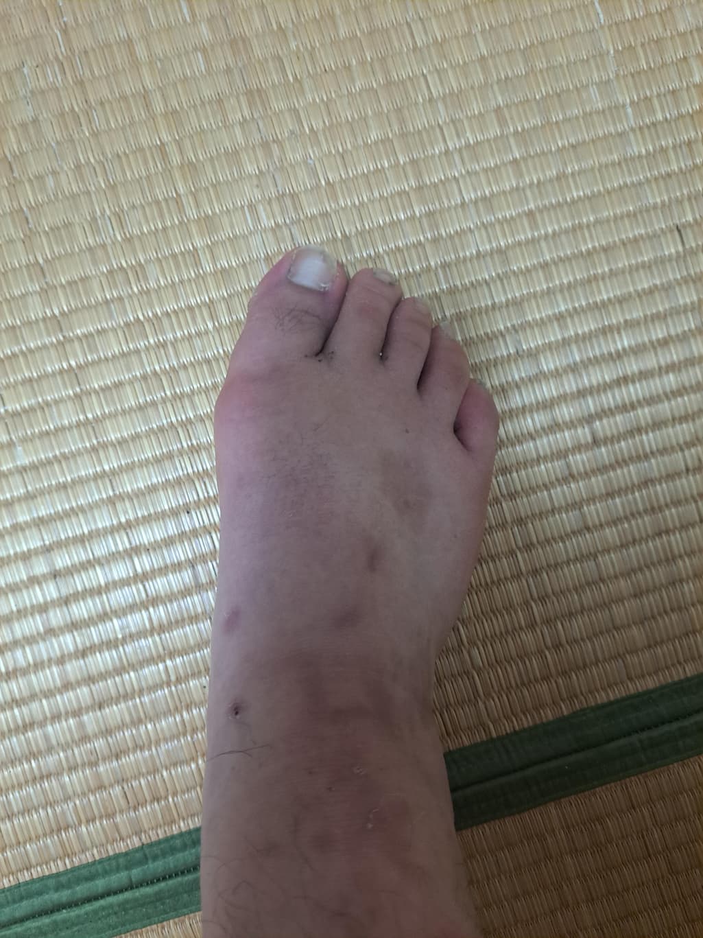 1번 째 사진