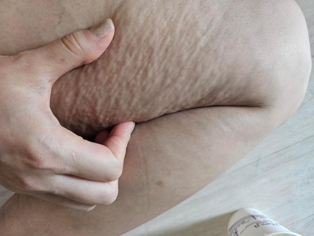 3번 째 사진