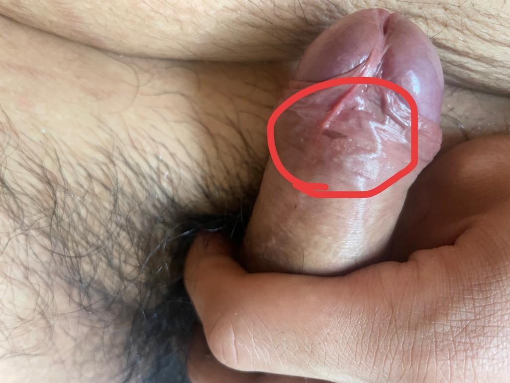 3번 째 사진