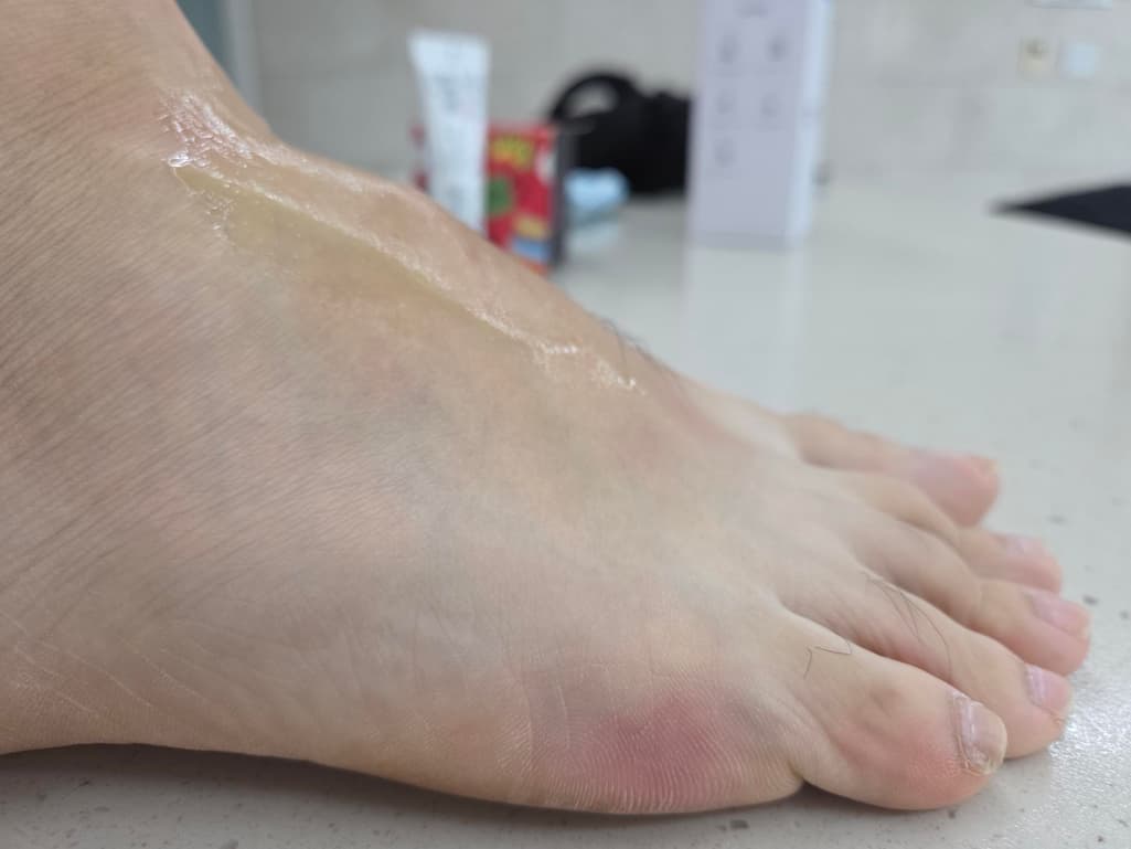 2번 째 사진