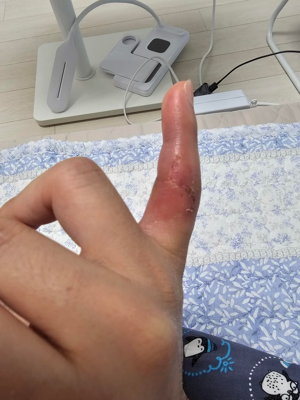 2번 째 사진