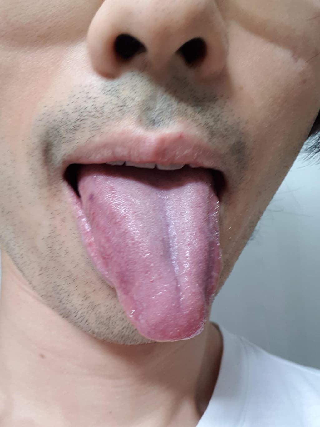 3번 째 사진