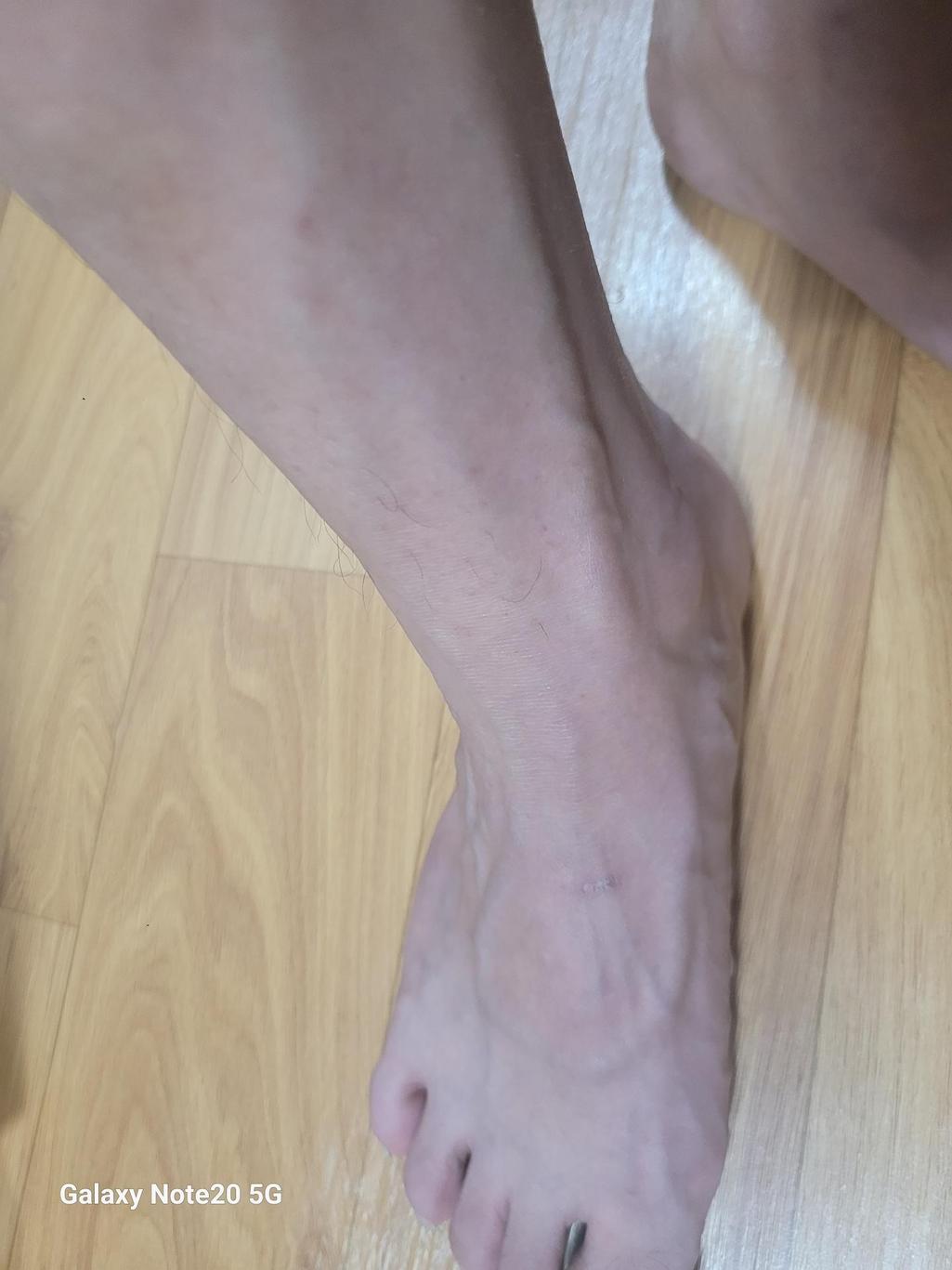 2번 째 사진