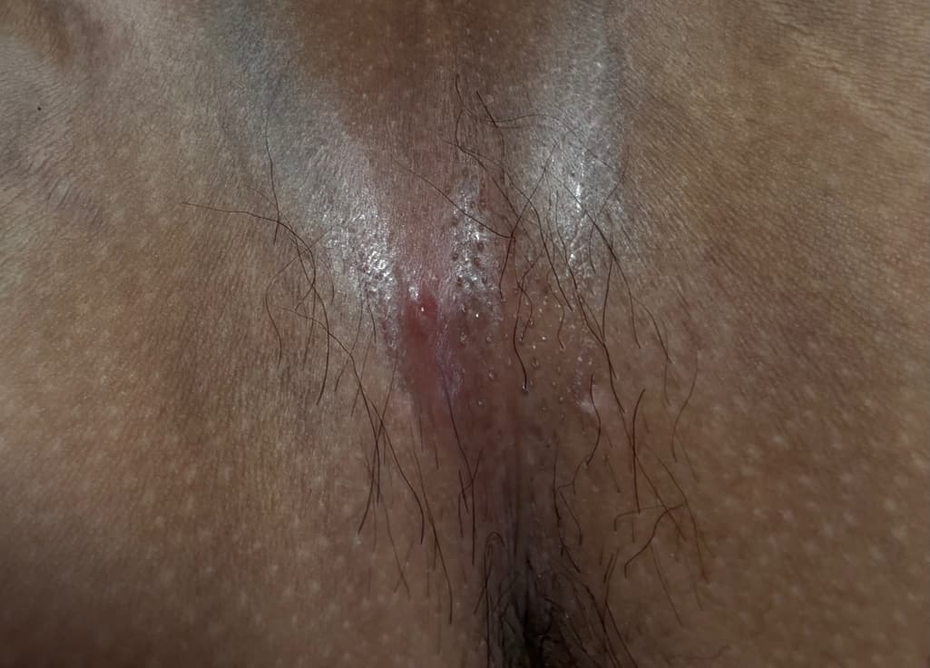 2번 째 사진