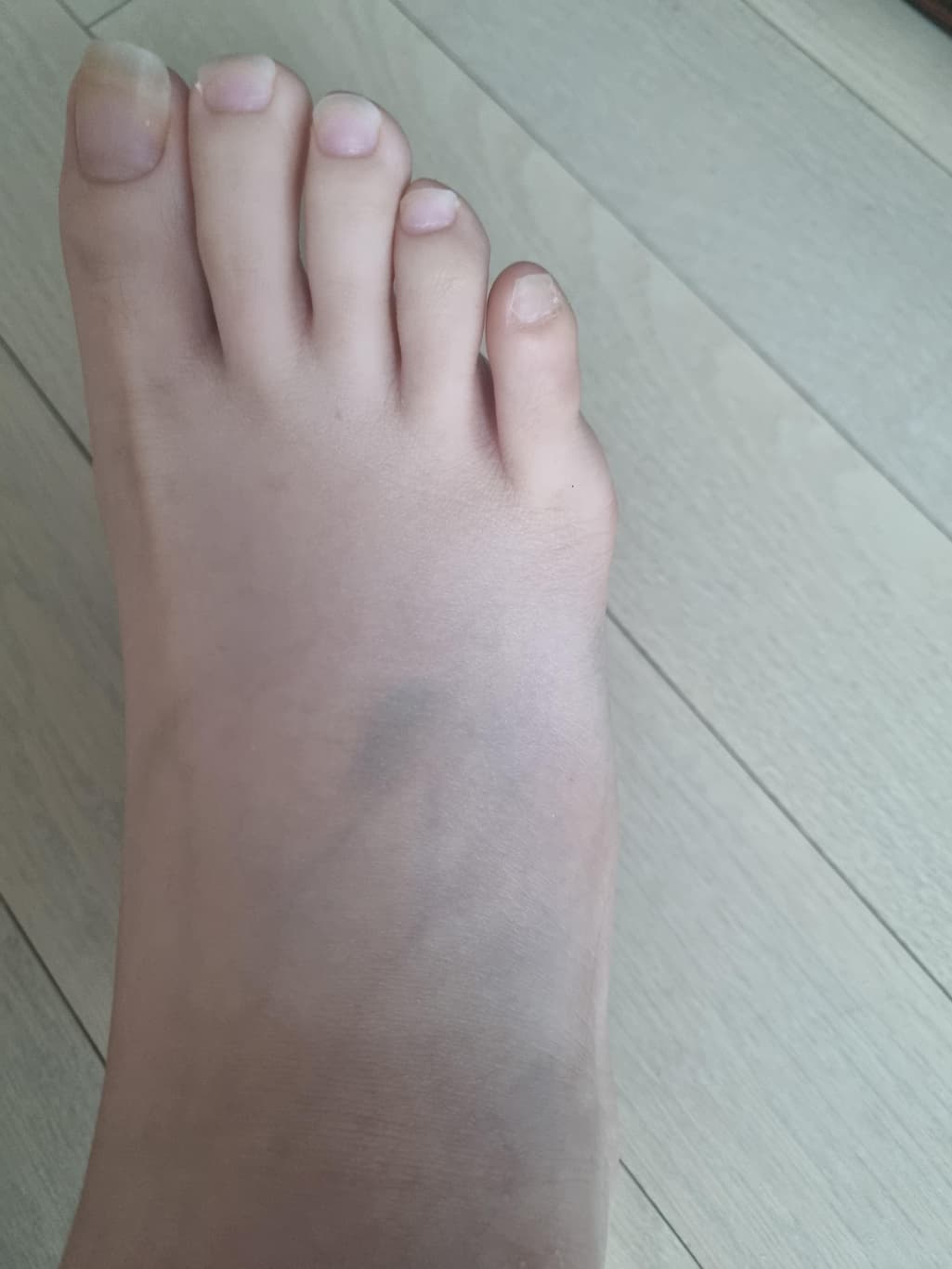 2번 째 사진