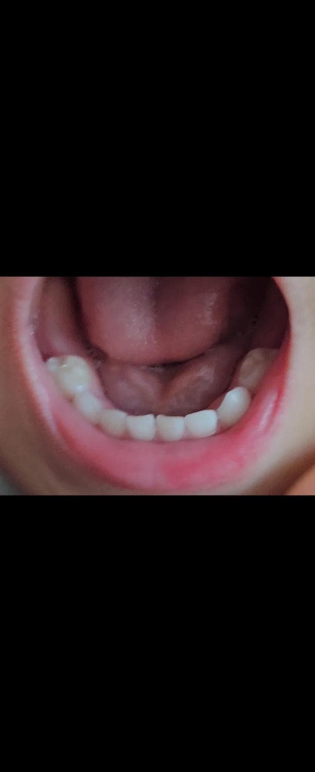 3번 째 사진