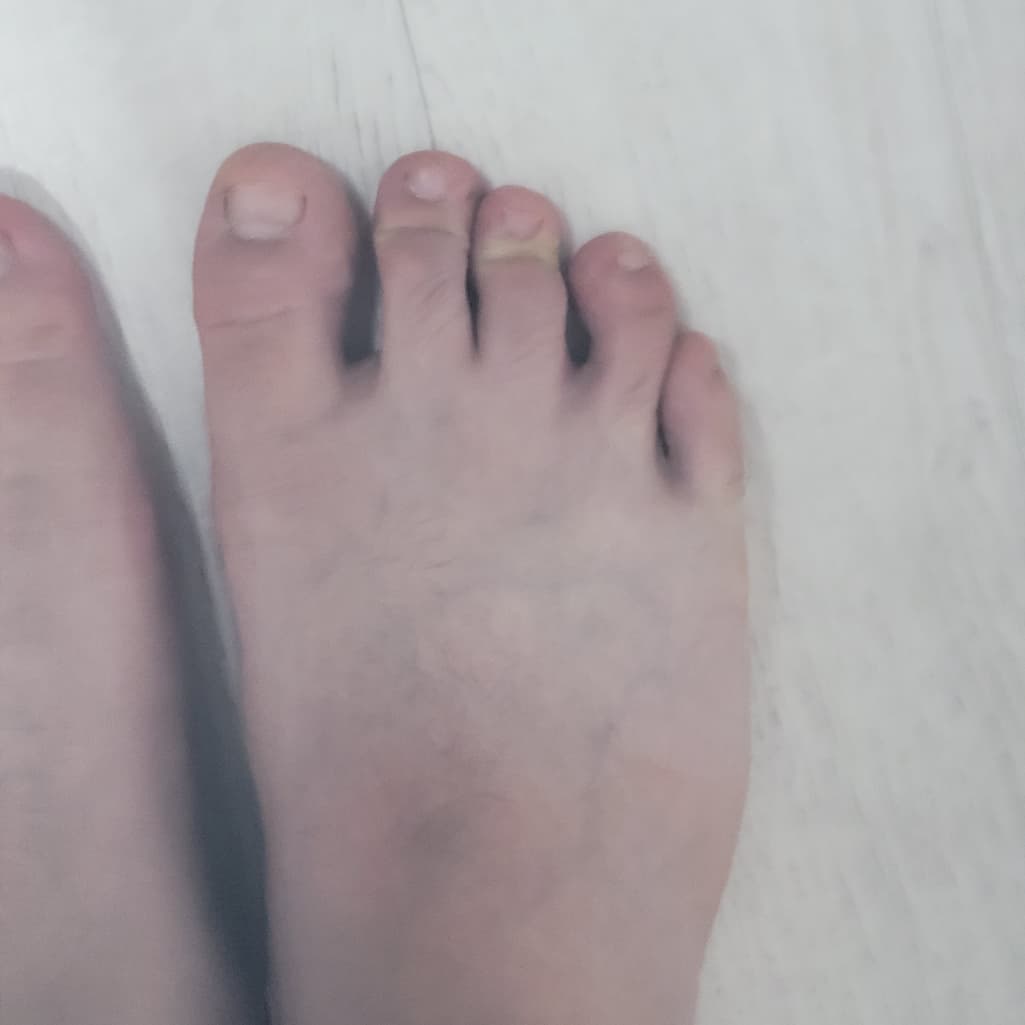 2번 째 사진