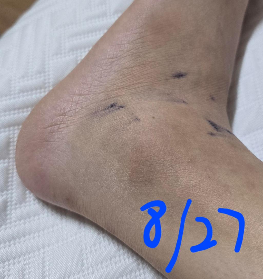 3번 째 사진