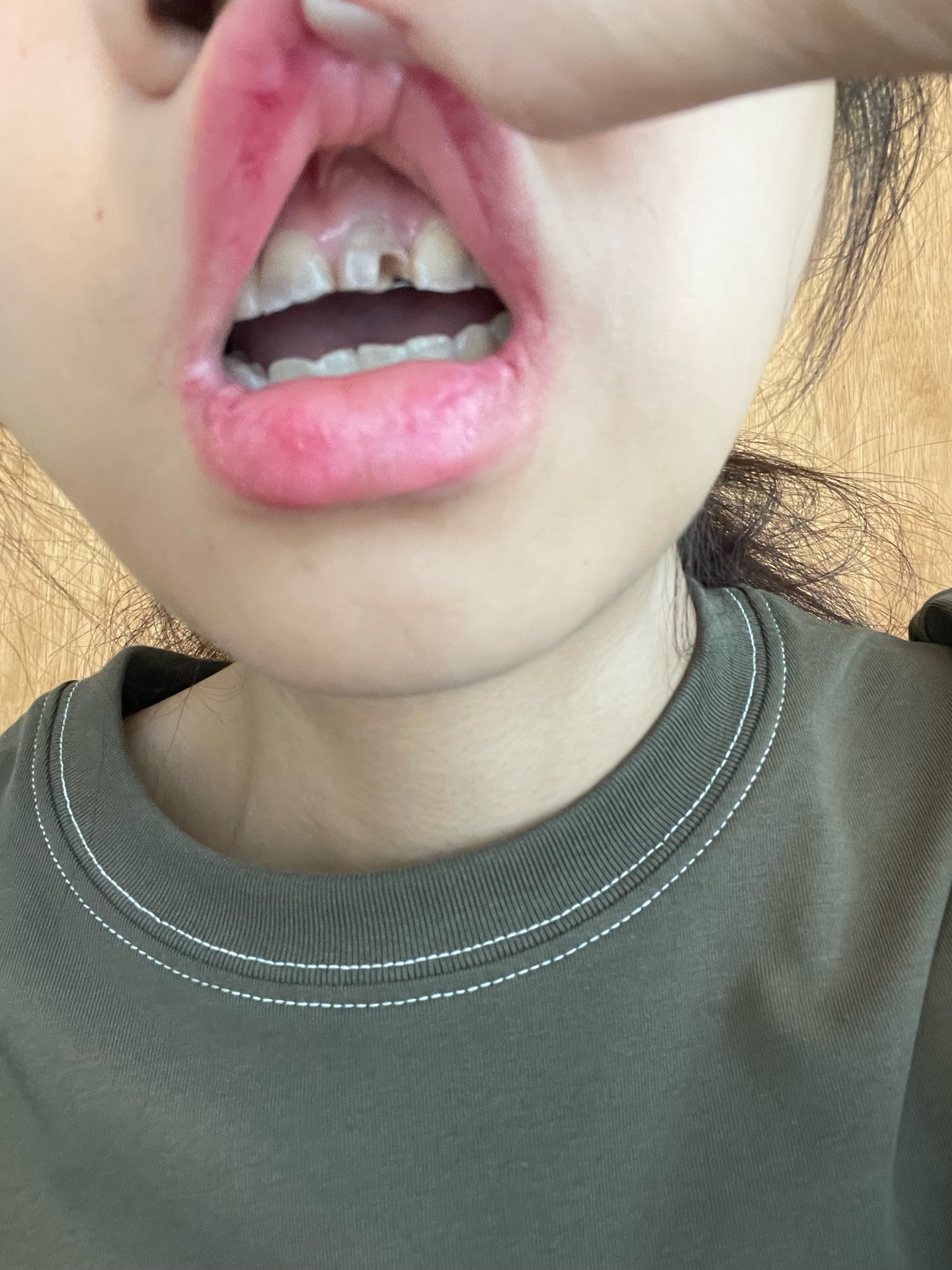 2번 째 사진