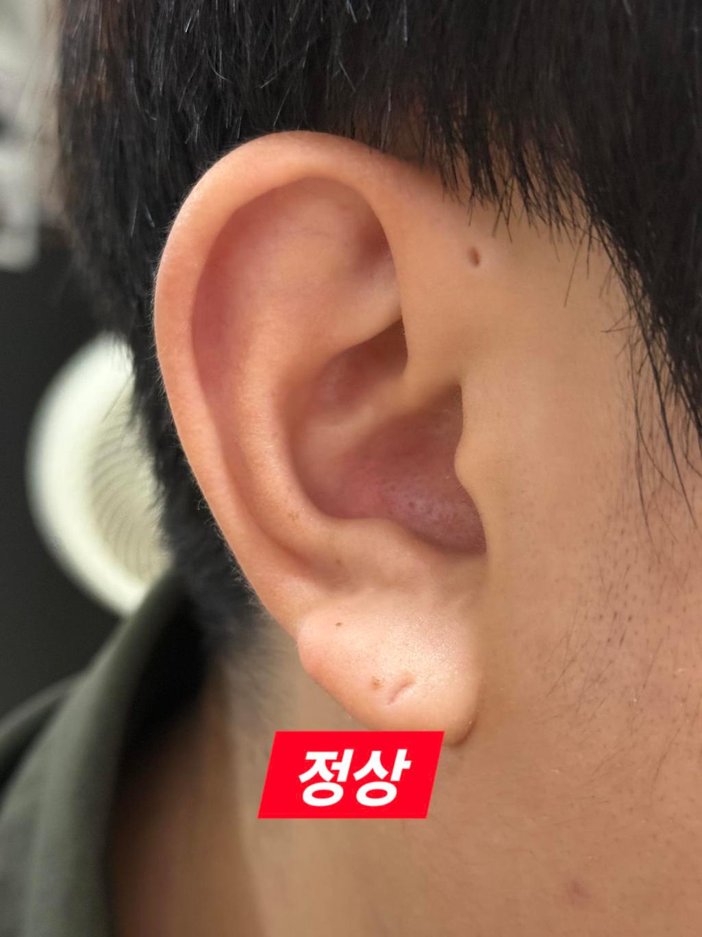 2번 째 사진