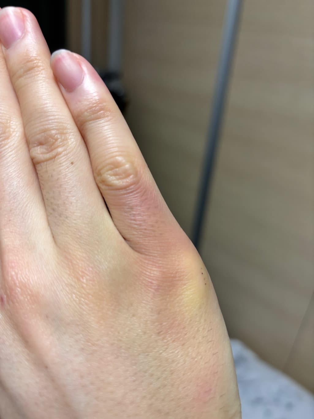 2번 째 사진