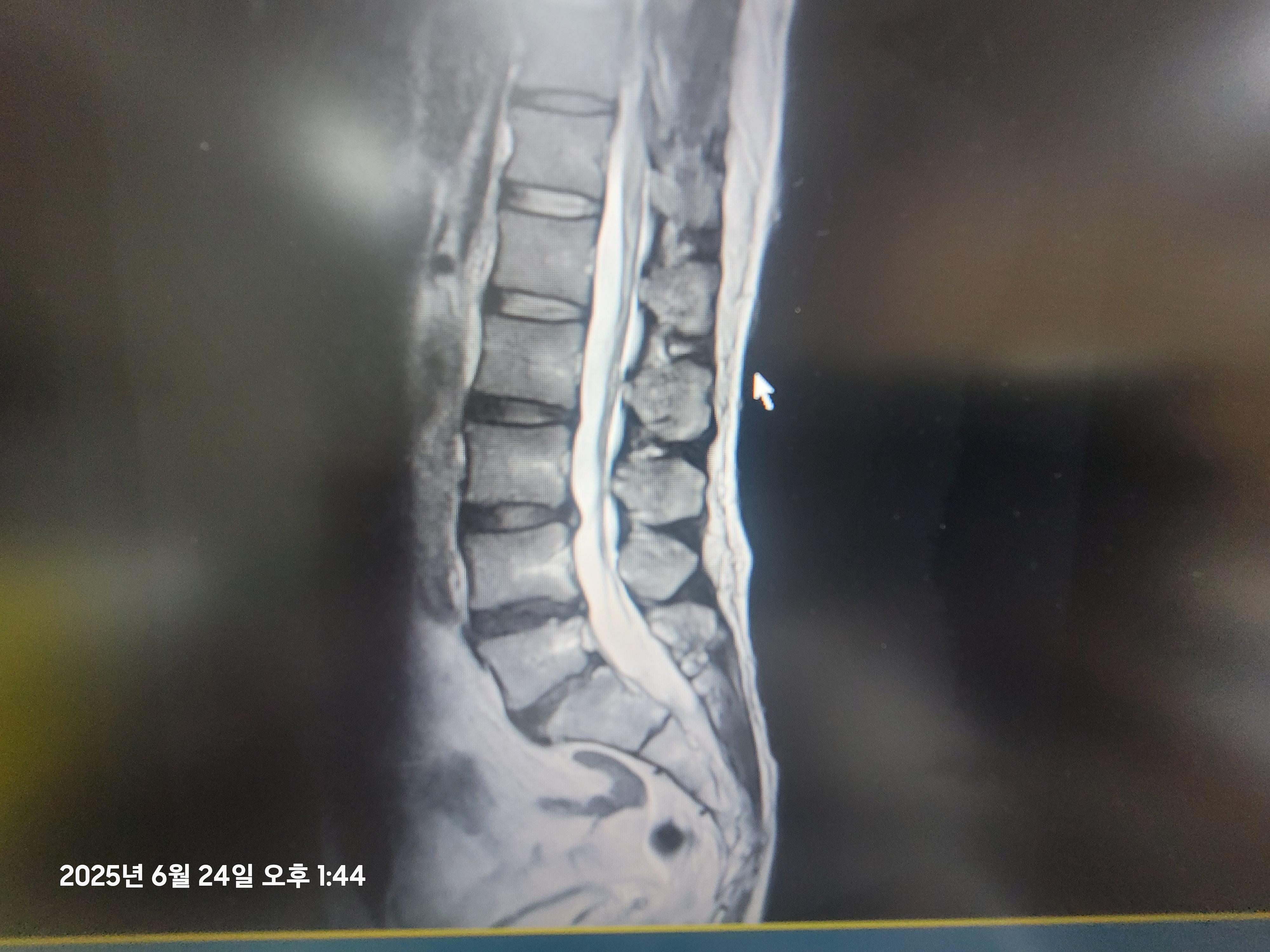 4번 째 사진