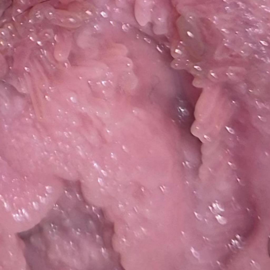 2번 째 사진