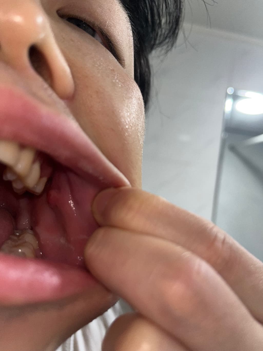 2번 째 사진