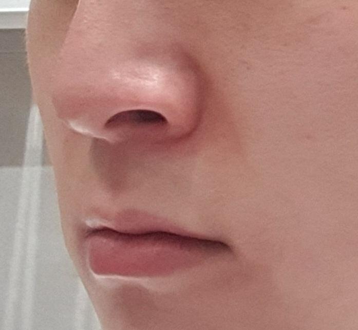 3번 째 사진