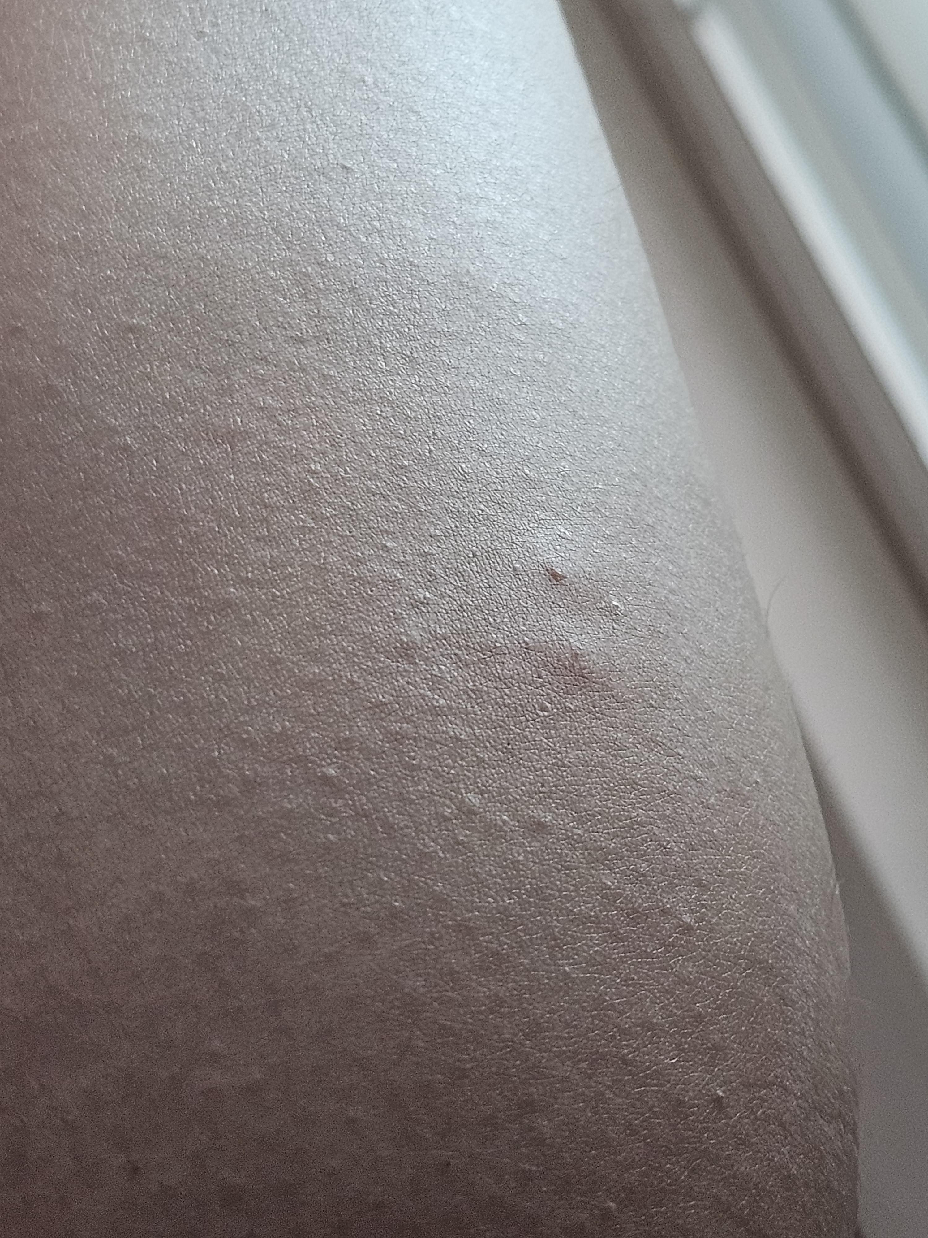 2번 째 사진