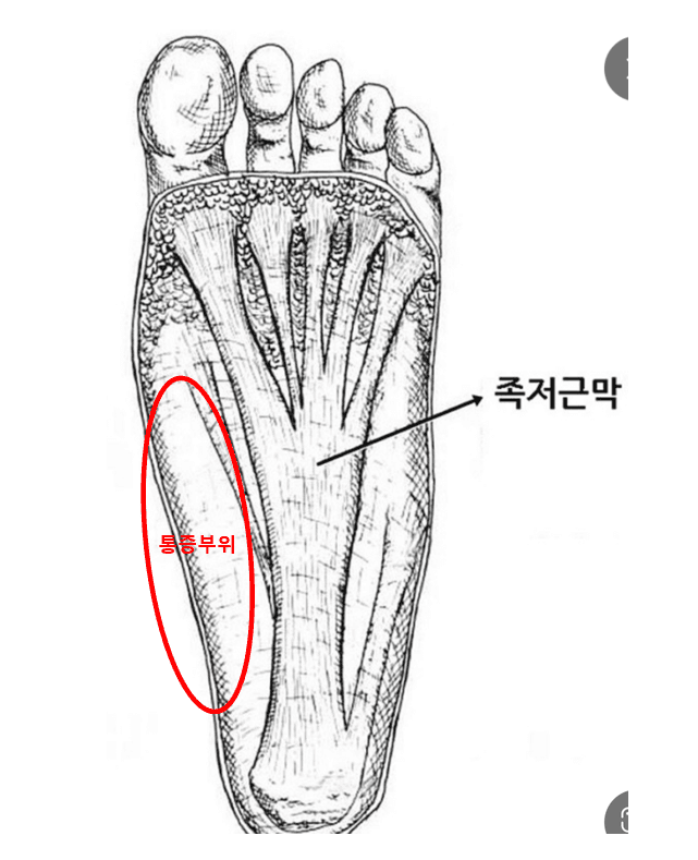 2번 째 사진