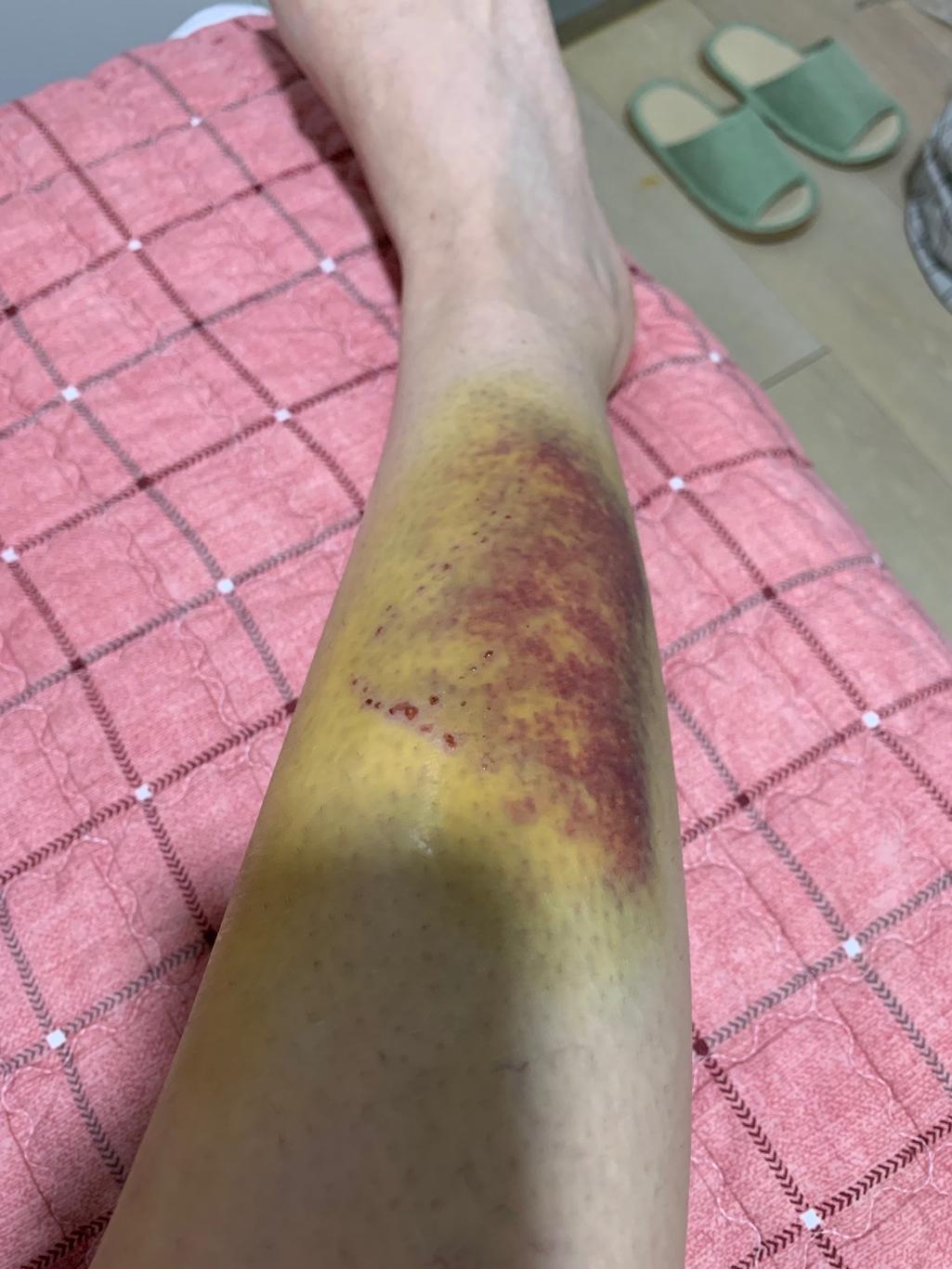 1번 째 사진