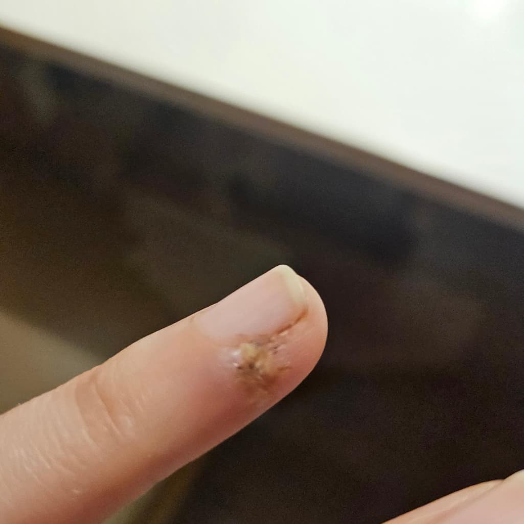 2번 째 사진