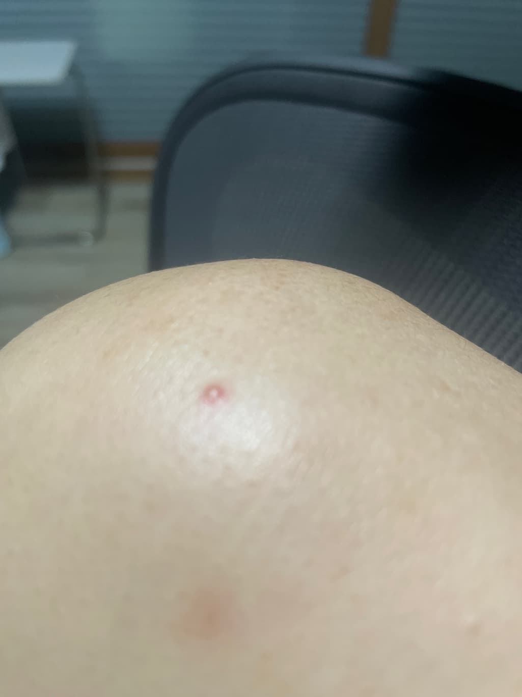 3번 째 사진