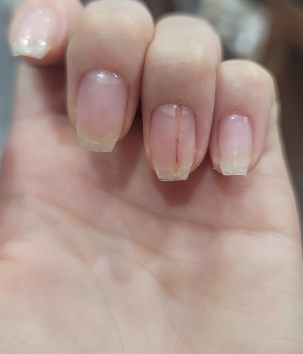 2번 째 사진