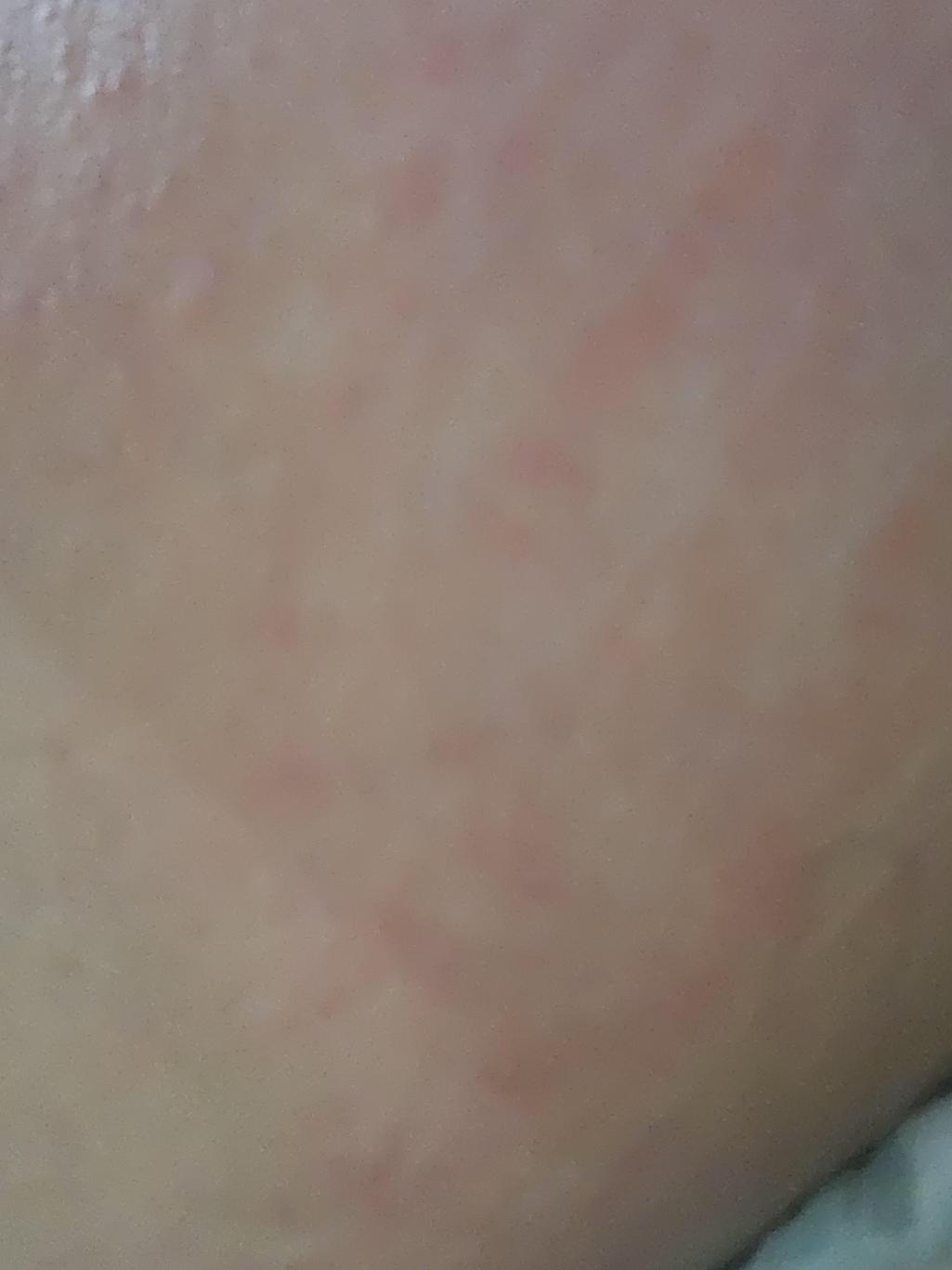 3번 째 사진
