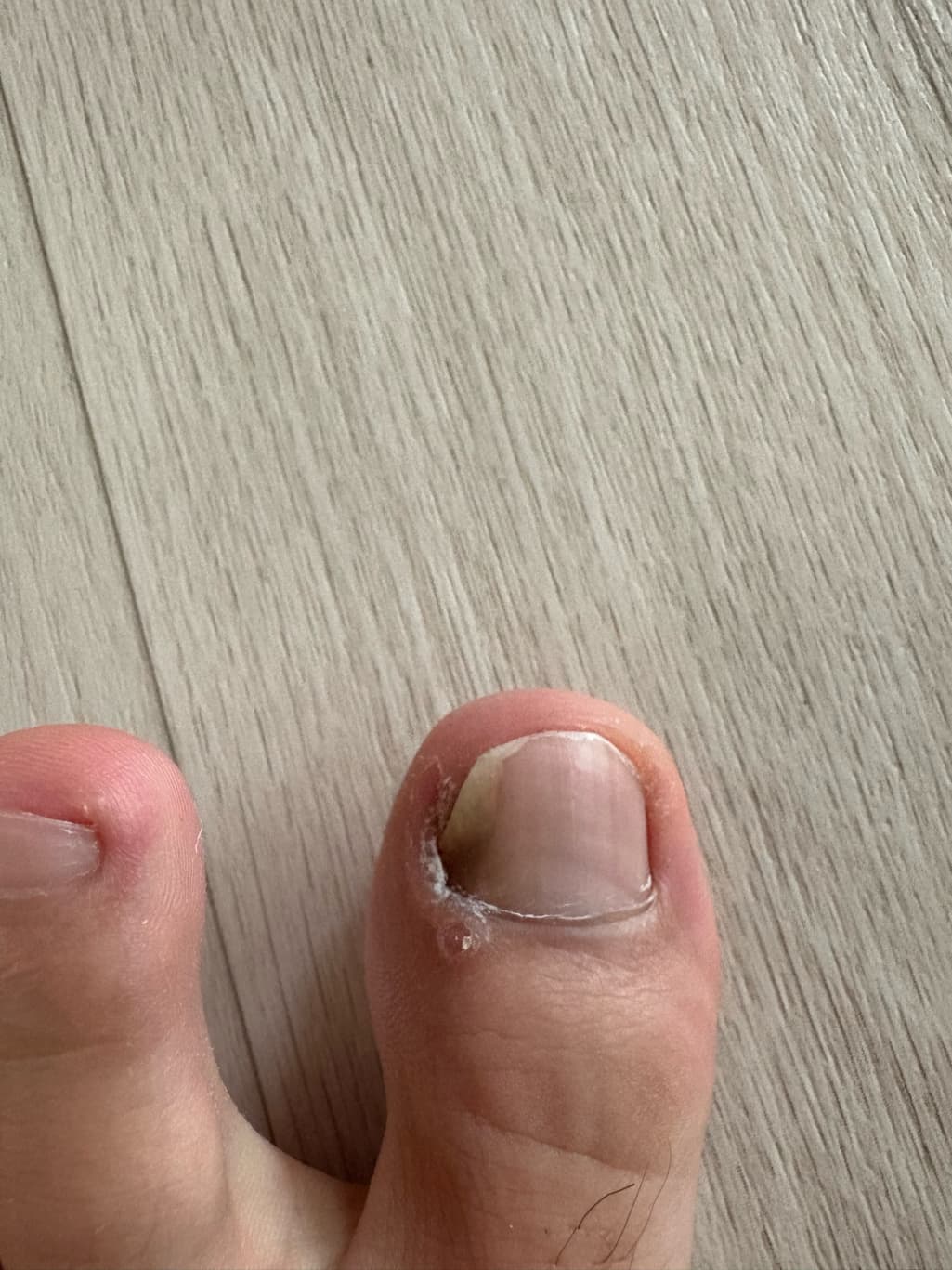 1번 째 사진