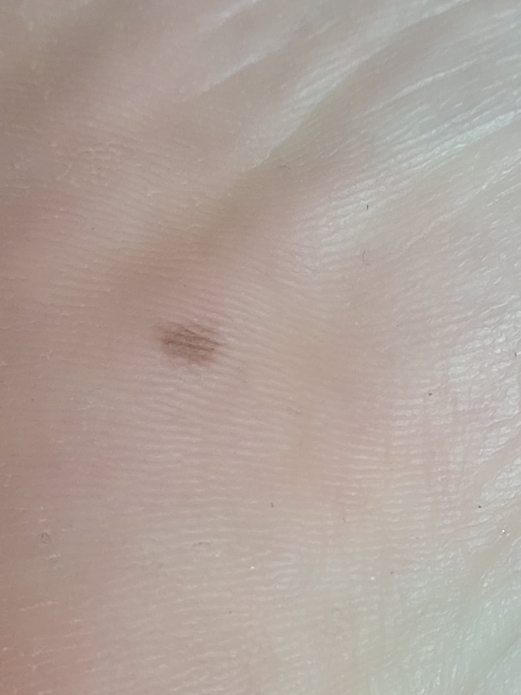 2번 째 사진