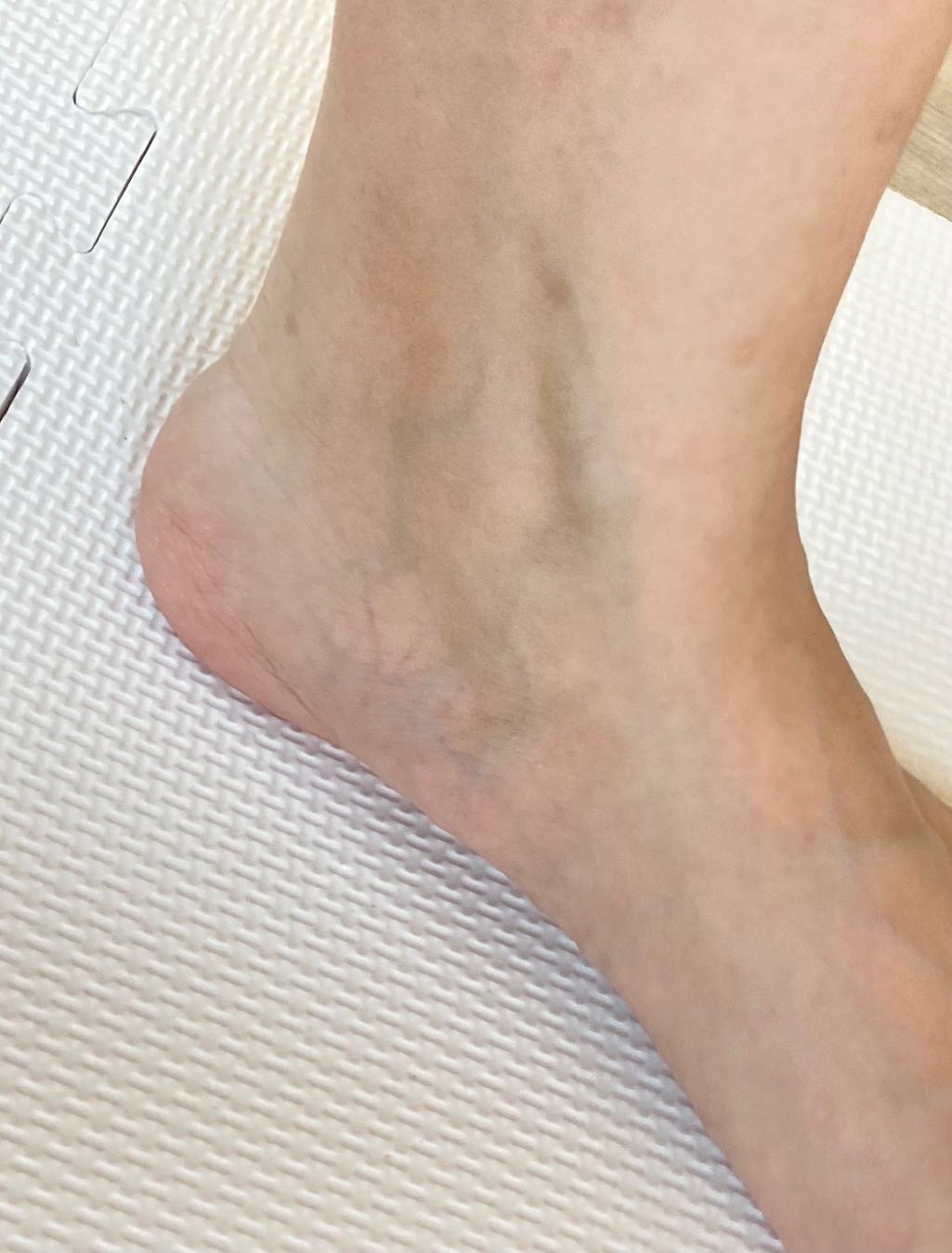 2번 째 사진
