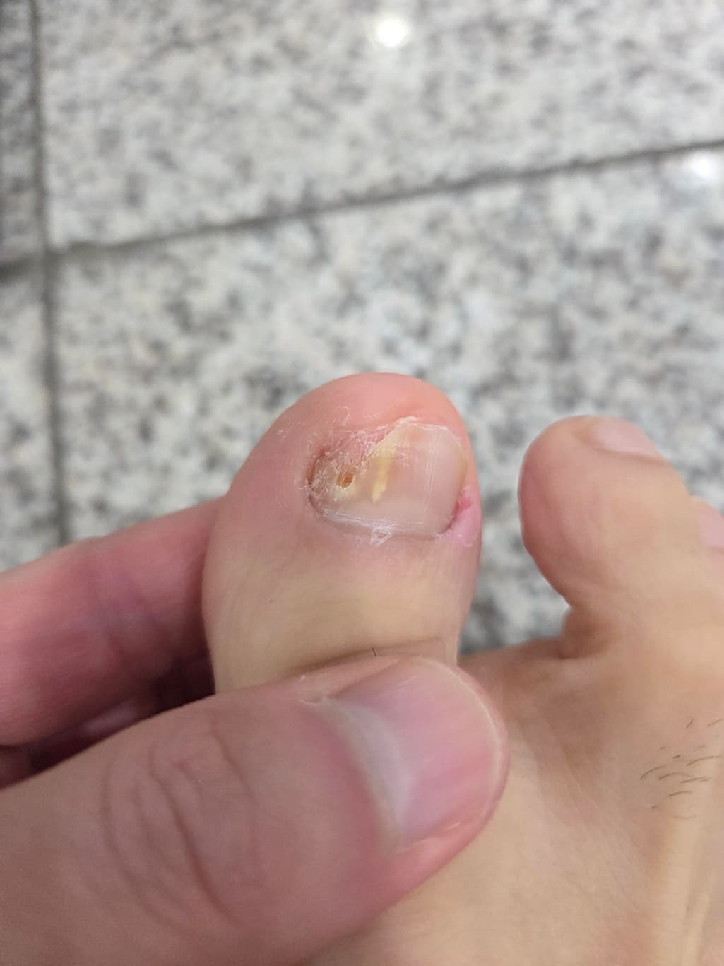 1번 째 사진