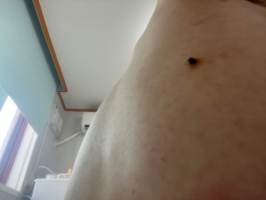 2번 째 사진