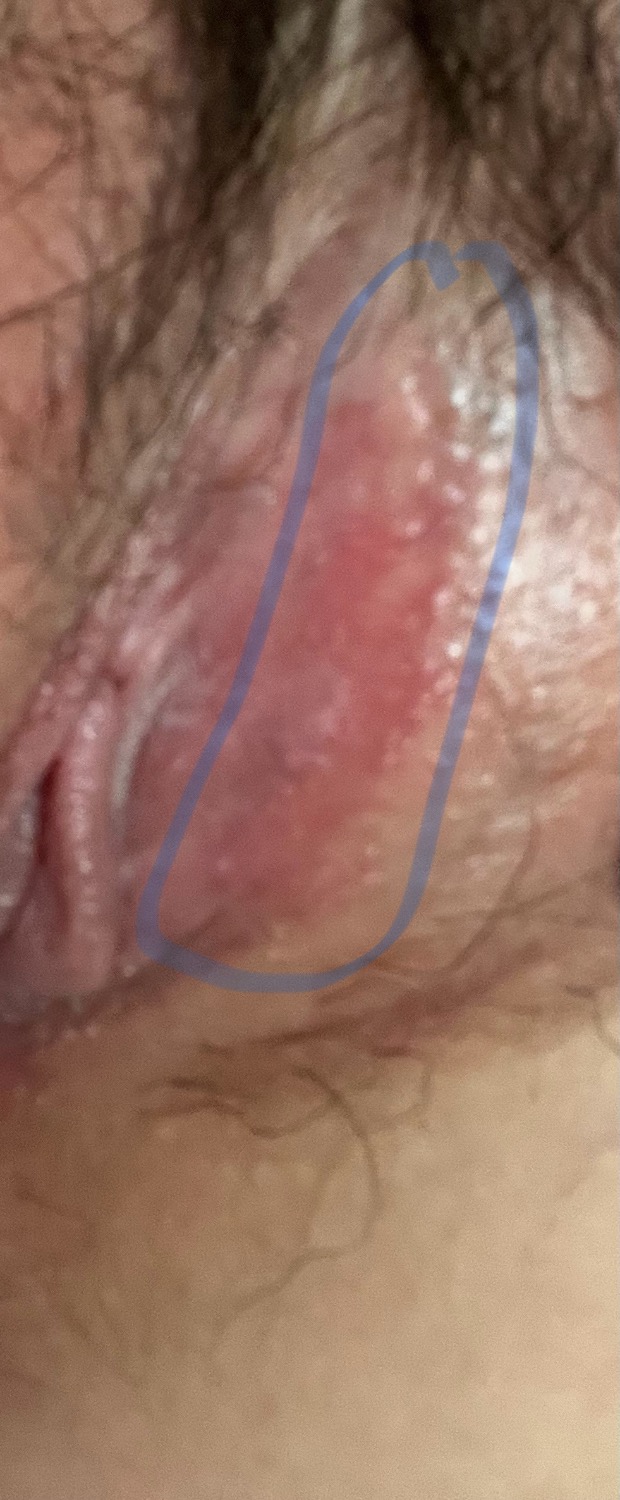 2번 째 사진