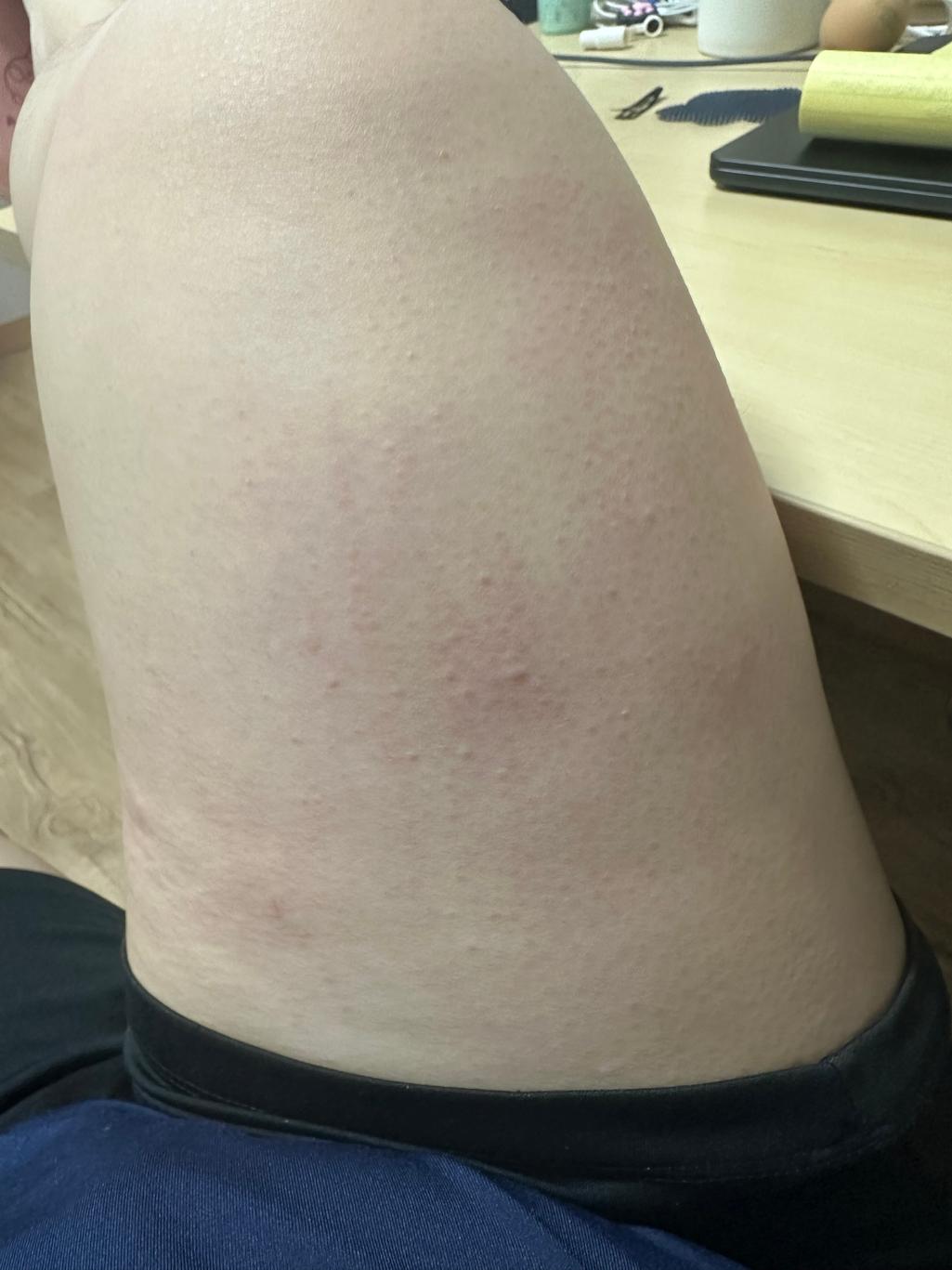 2번 째 사진
