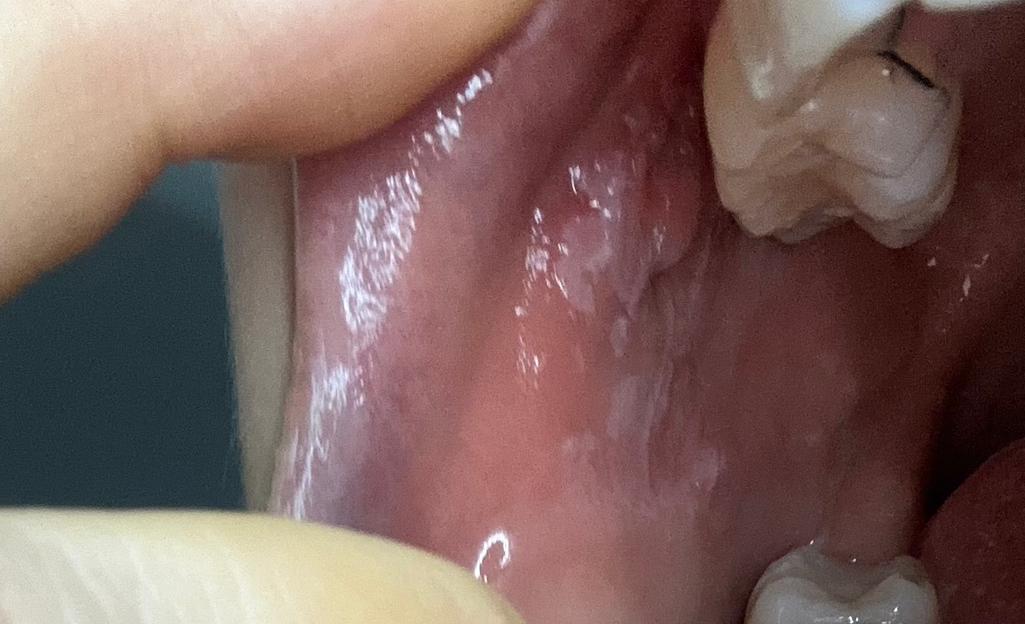 2번 째 사진