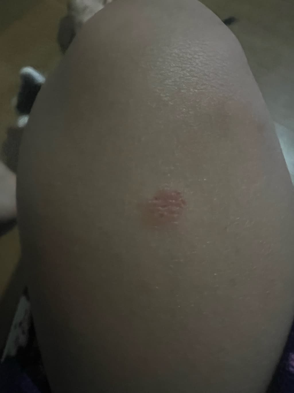2번 째 사진